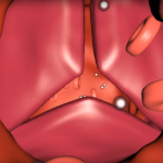 3d анимация работы клапанов сердца